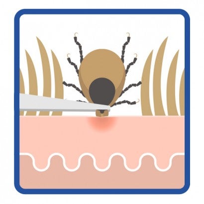 Icon illustration of a tick being removed from a pet